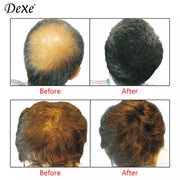 Dexe ≡ Fibre Capillaire Black 22g